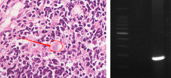 皇冠信用网APP下载_上海确诊1例!张文宏团队参与会诊!病死率极高皇冠信用网APP下载,发病一周内迅速恶化