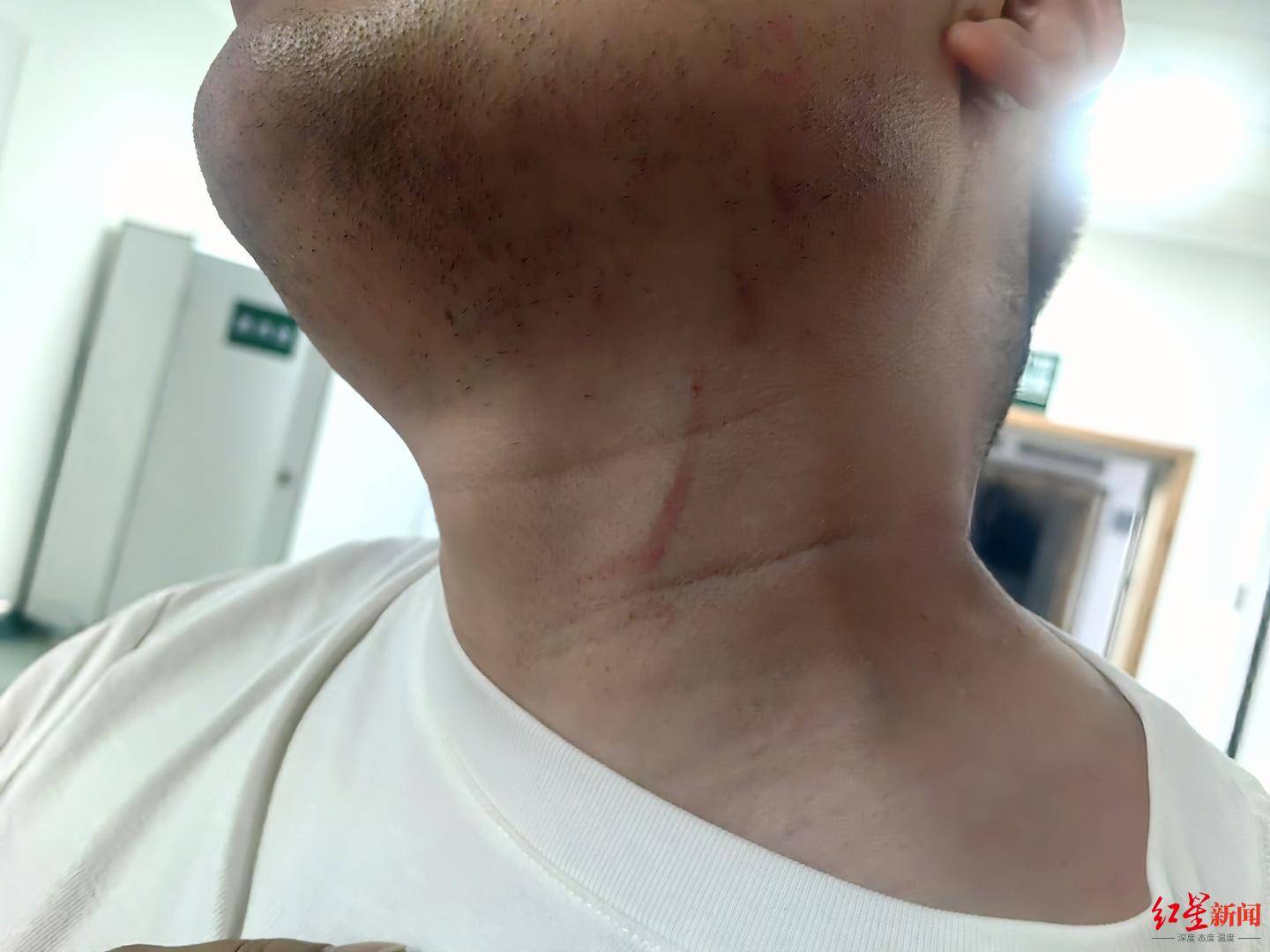 皇冠信用网如何注册
_武汉男子拍摄违停时被当街殴打皇冠信用网如何注册
,打人者被罚款500元,被打者称将提起行政复议并起诉