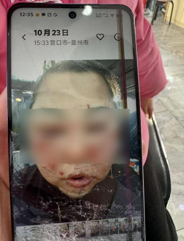 奥地利vs塞浦路斯_被前夫打进ICU的女子不幸身亡奥地利vs塞浦路斯，大女儿称正送母亲去殡仪馆，今后安排暂未考虑，希望严惩凶手